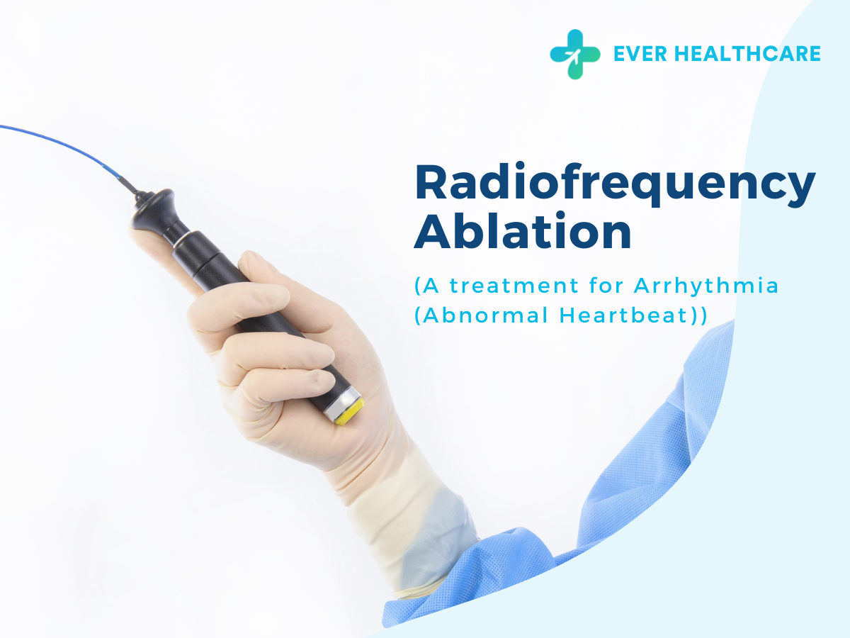 Radiofrequency Ablation in Thailand 2023 Compare Price & Reviews